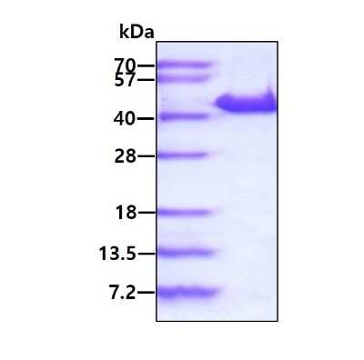 SDS-Page: Recombinant Human YOD1 His Protein [NBP2-22955] - 3ug by SDS-PAGE under reducing condition and visualized by coomassie blue stain.
